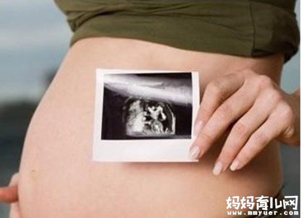 六个月的胎儿图什么样 五张胎儿图来解读 - 孕期检查