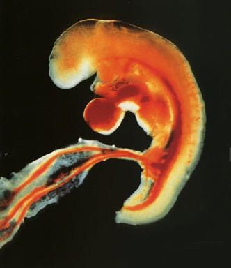 检查胎儿畸形有什么方法