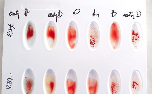 抽10周孕妇血鉴定胎儿血型,如何决定胎儿的血型