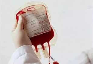 输血血型不对皮肤,为什么输血时血型不合会产生凝结