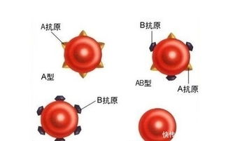 怎样通过a抗体b抗体看血型,抗A抗B可以测出小宝的血型吗