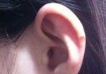 耳轮有痣代表什么 耳朵没有耳轮好不好